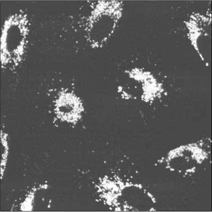 HypoxiTRAK