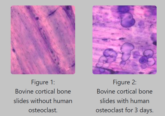 Boneslices Boneslices