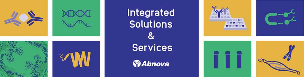 68d9ece5a8248.jpg Abnova-services.jpg